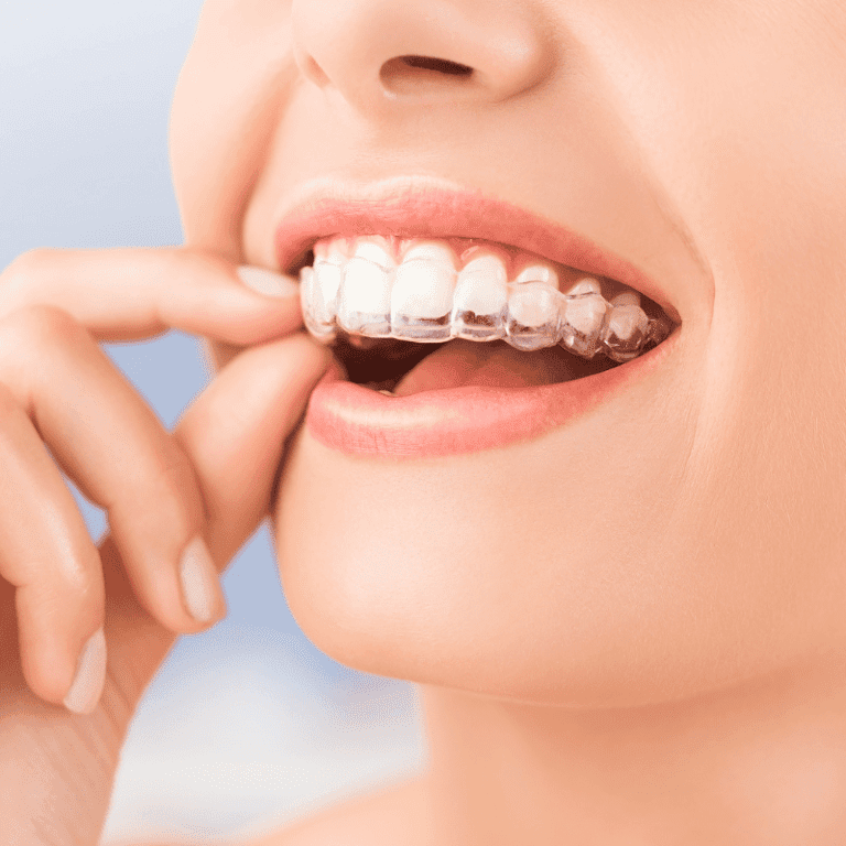 Clínica Dental Molí - Odontología en Ripollet|Ortodoncia